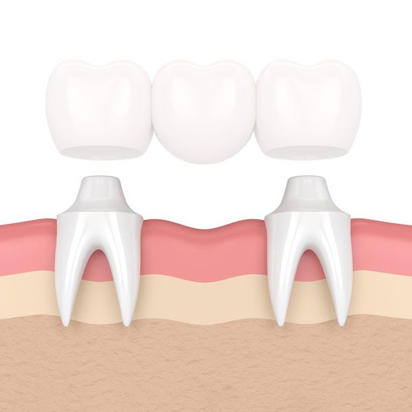 Illustration of traditional bridge