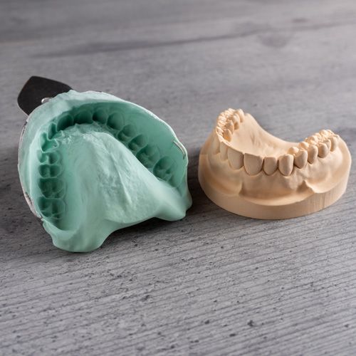 Dental models